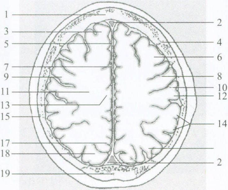 颅脑CT横断面解剖